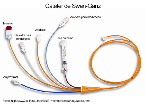 Cateter de Swan-Ganz